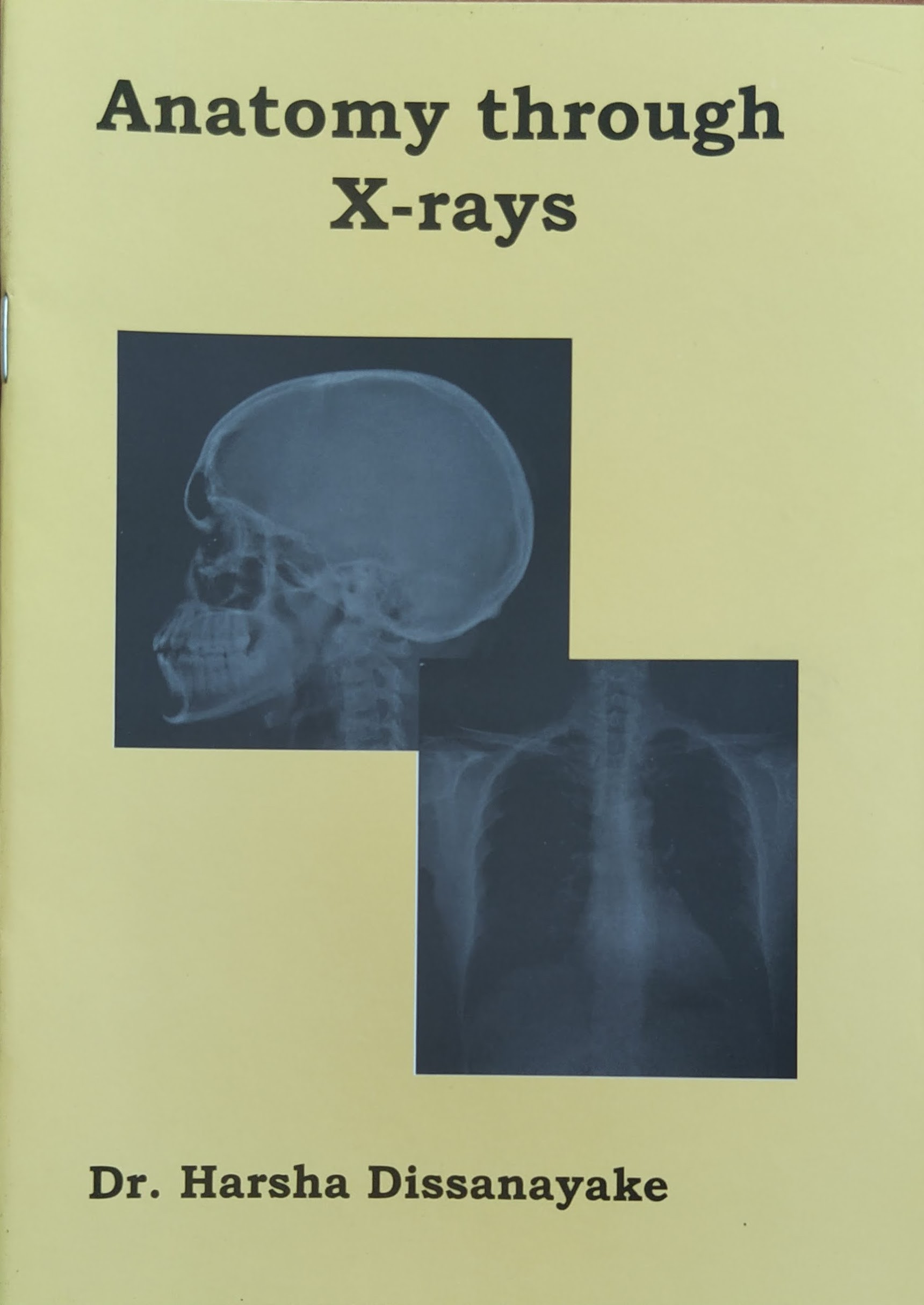 Cover of Anatomy Through X-rays