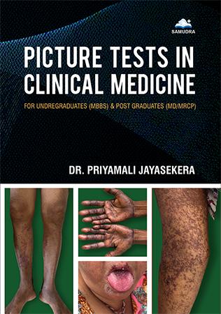 Cover of Picture Test in Clinical Medicine for Undergraduates (MBBS) & Postgraduates (MD/MRCP)