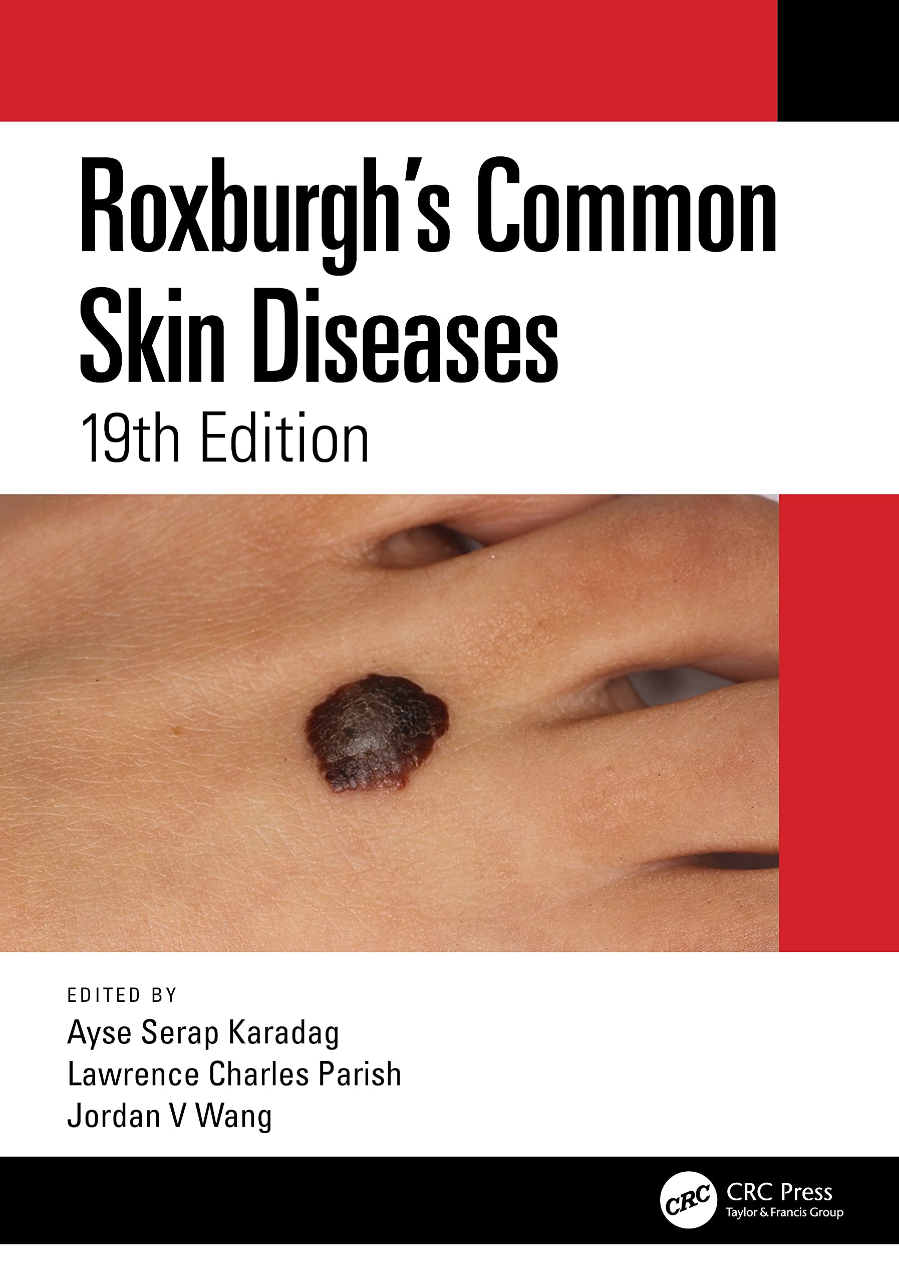 Cover of Roxburgh's Common Skin Diseases
