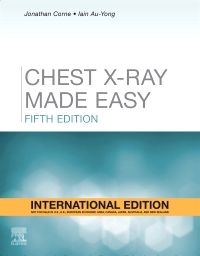 Cover of Chest X-ray Made Easy